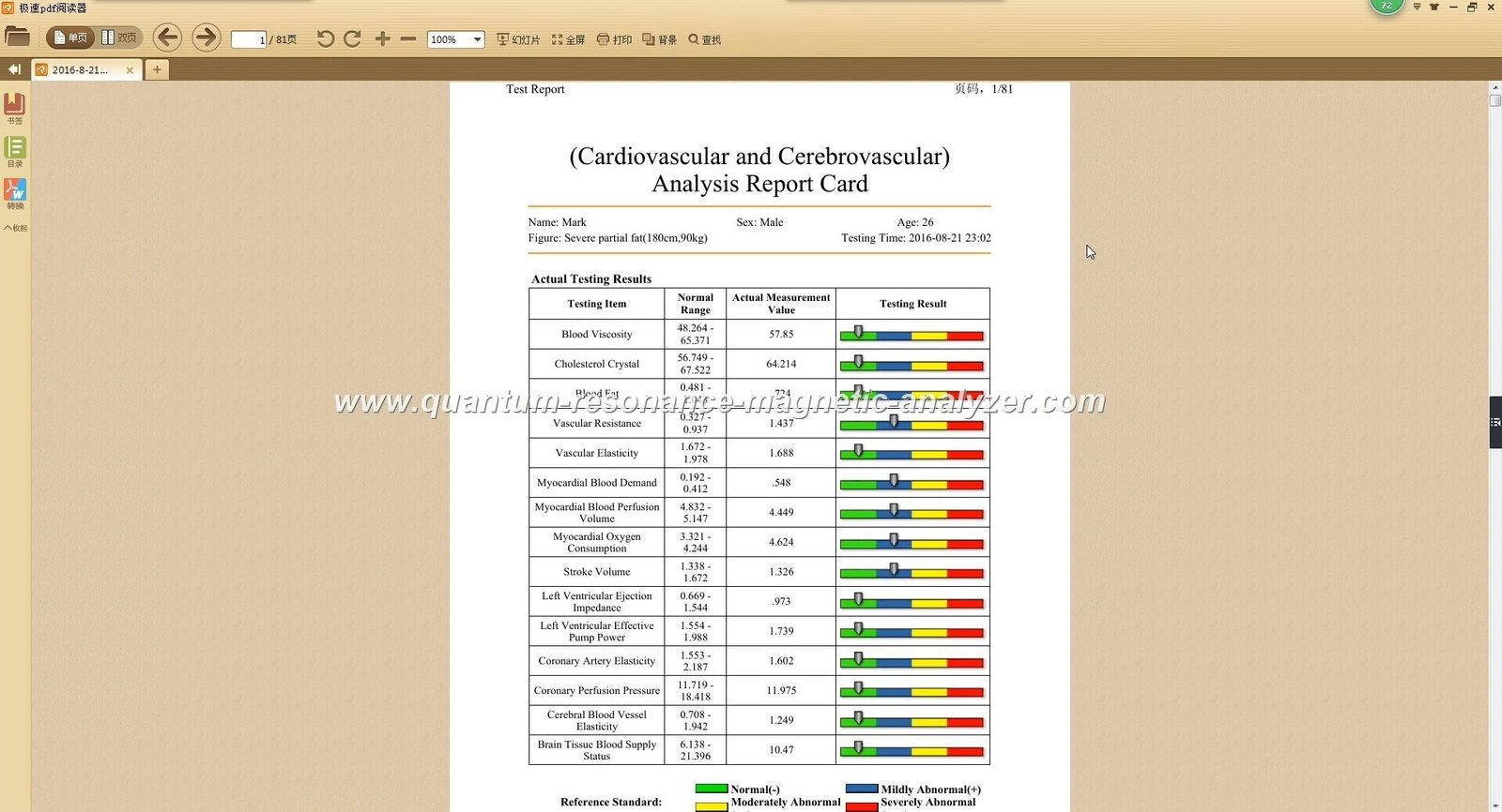 Comparación de reportes del analizador cuántico mostrando variaciones en resultados